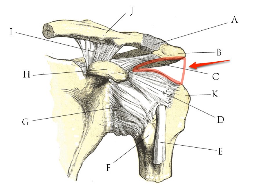 subacromial space - overhead position